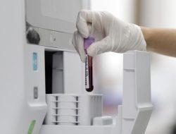 Sampel Darah Pasien Gagal Ginjal Akut Diteliti Tim Labfor Polri